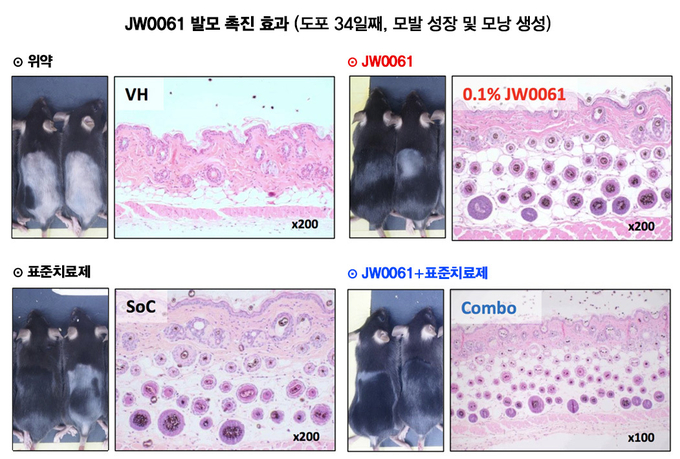 JW중외제약은 11월 15일부터 닷새 동안 일본에서 열린 ‘Wnt 2022’ 학회에서 Wnt 표적 탈모치료제 'JW0061'의 전임상 결과를 포스터 발표했다. JW0061은 휴지기 단계의 동물을 대상으로 약물 도포를 시작한지 34일째 기준 위약군 대비 우수한 모발 성장 촉진과 모낭 수 증가 효과를 나타냈다. 또한 표준치료제(SoC)와의 병용 치료는 발모 촉진에 최대 효과를 보였다. 모발의 성장은 생장기, 퇴행기, 휴지기 순으로 세 단계가 주기적으로 반복되는데, 평균 50일 이상 소요되는 생장기 진입 시점을 JW0061 도포로 15일 이상 앞당긴 결과다.(사진=JW중외제약)